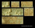 mycobacterium tuberculosis growth on L�wenstein-Jensen(L-J) medium